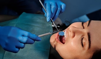 Comparing Periodontal Care & Regular Cleaning | Cathedral City