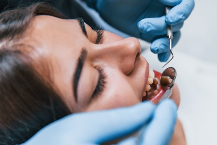 Say Goodbye to Cavities with Dental Fillings in Cathedral City